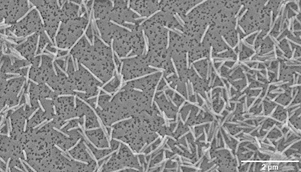 Scanning electron microscopy of the T-12 T strain of F. facile after 48 h of incubation at 20°C in TYES broth.