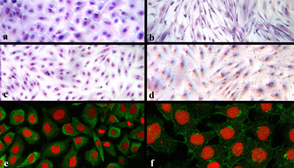 Atlantic salmon gill cell lines: ASG-10 (a, c, e, and f) and ASG-13 (b and d)